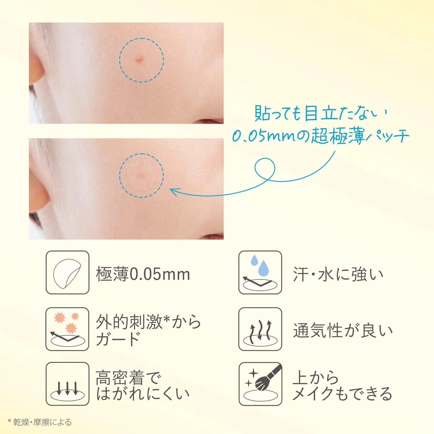 KOSE CLEAR TURN ごめんね素肌 藥用抗痘 痘痘貼 46枚入